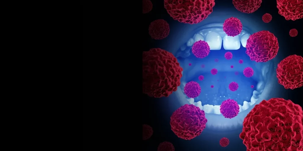 Oral Cancer Surgeon - Dr. Natasha Lalwani